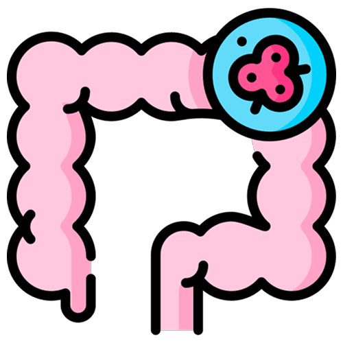 Colorectal cancer