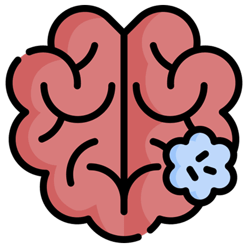 Glioma